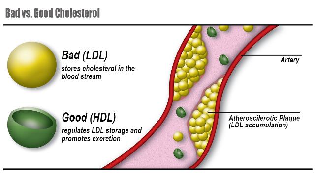 A detailed diagram showing the structure of cholesterol molecules, differentiating between LDL and HDL.